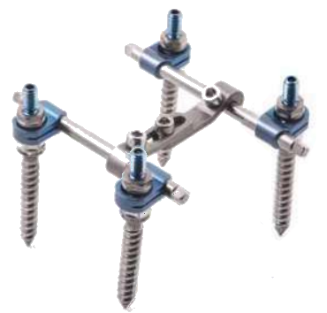 Транспедикулярна система фіксації хребта з 4 напівсферичними поліаксіальними гвинтами "Tria"